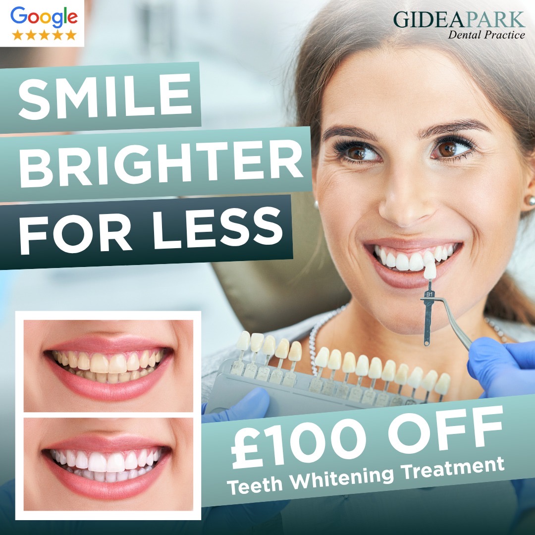 Smile brighter for less: £100 off teeth whitening treatment